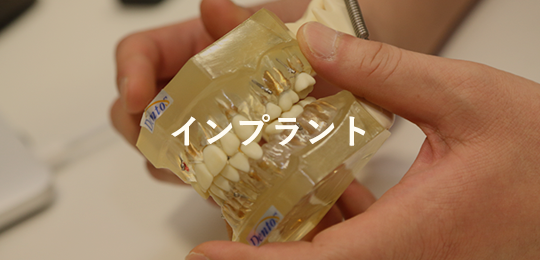 インプラント